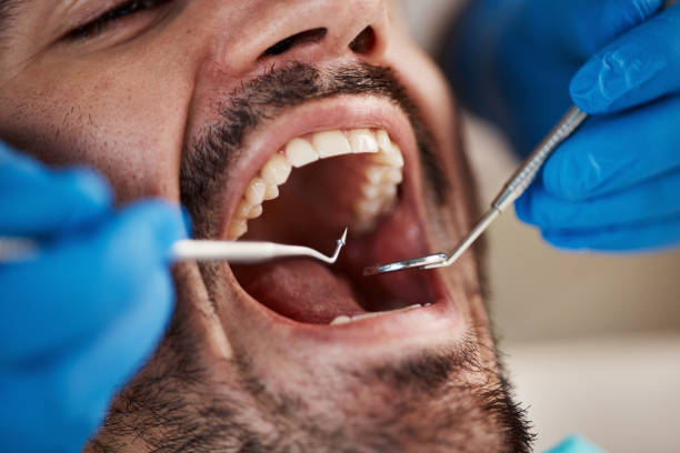 Best Emergency Denture Repair in Bonneauville, PA